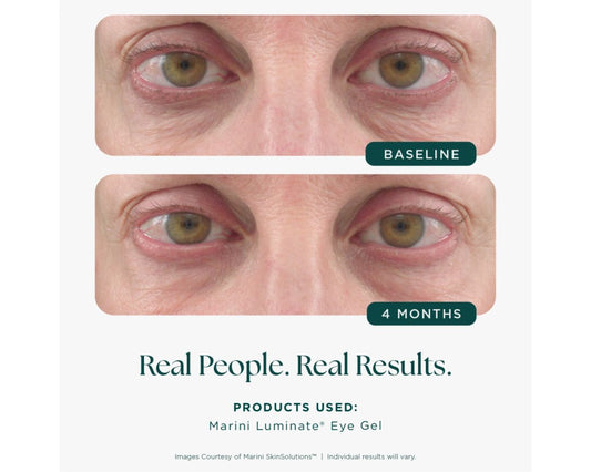 Marini Luminate Eye Gel