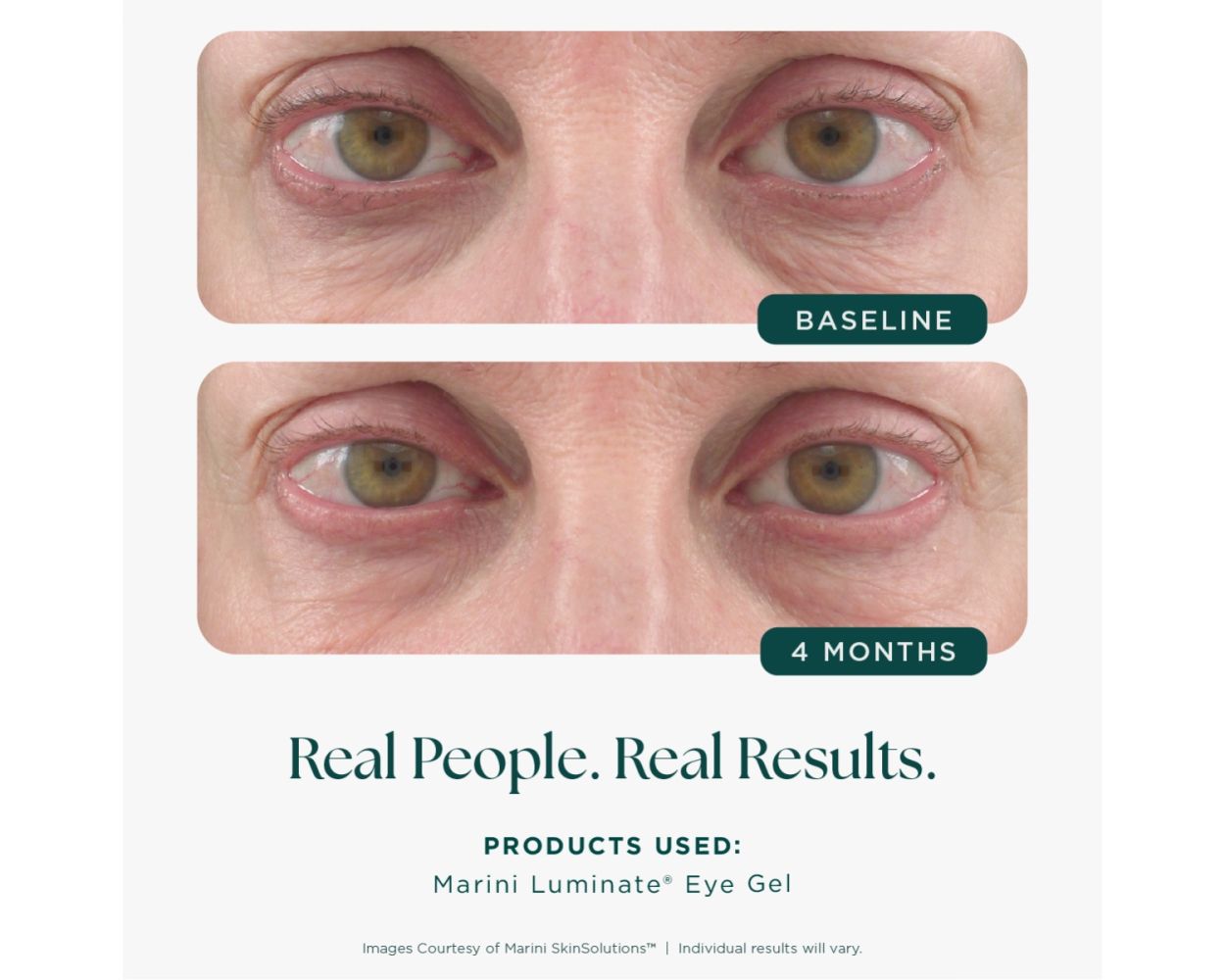 Marini Luminate Eye Gel
